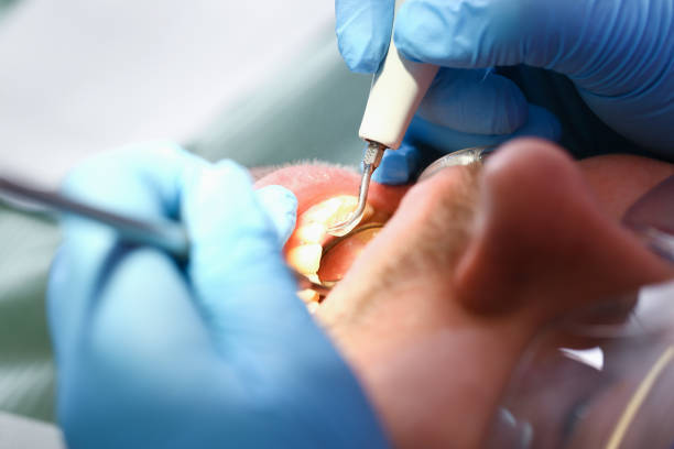 Best Emergency Treatment for Oral Infections in Gold Beach, OR