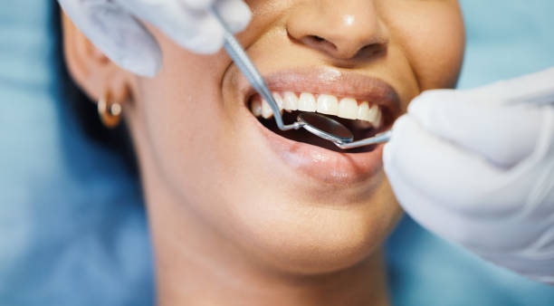 Best Dental Abscess Treatment in Gold Beach, OR