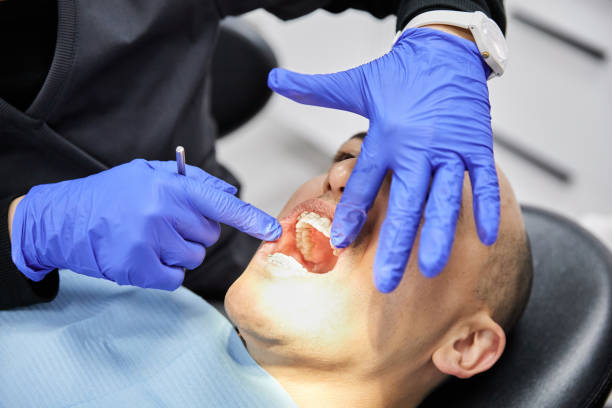 Best Emergency Denture Repair in Gold Beach, OR